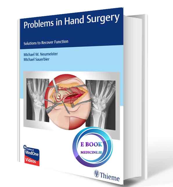 دانلود کتابProblems in Hand Surgery: Solutions to Recover Function  2020(ORIGINAL PDF)